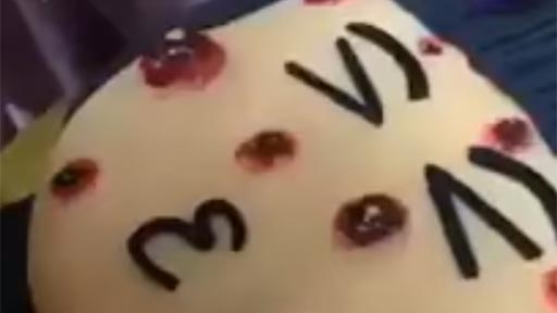 Una tarta con espinillas