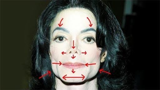 Michael Jackson sin ciruga plstica